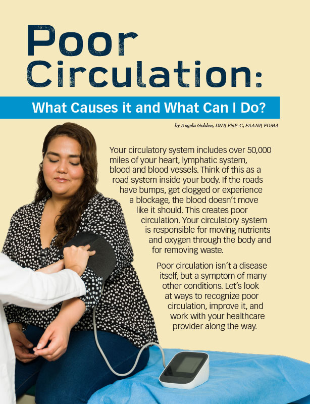 Poor Circulation: What Causes it and What Can I Do? - Obesity Action  Coalition